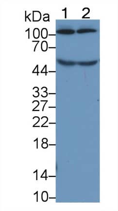 Western Blot: Complement Component C5a Antibody (D4) [NBP3-41581] - Sample: Lane1: Human Serum; Lane2: Human Plasma Primary Ab: 5ug/ml NBP3-41581; Second Ab: 0.2ug/mL HRP-Linked Caprine Anti-Mouse IgG Polyclonal Antibody