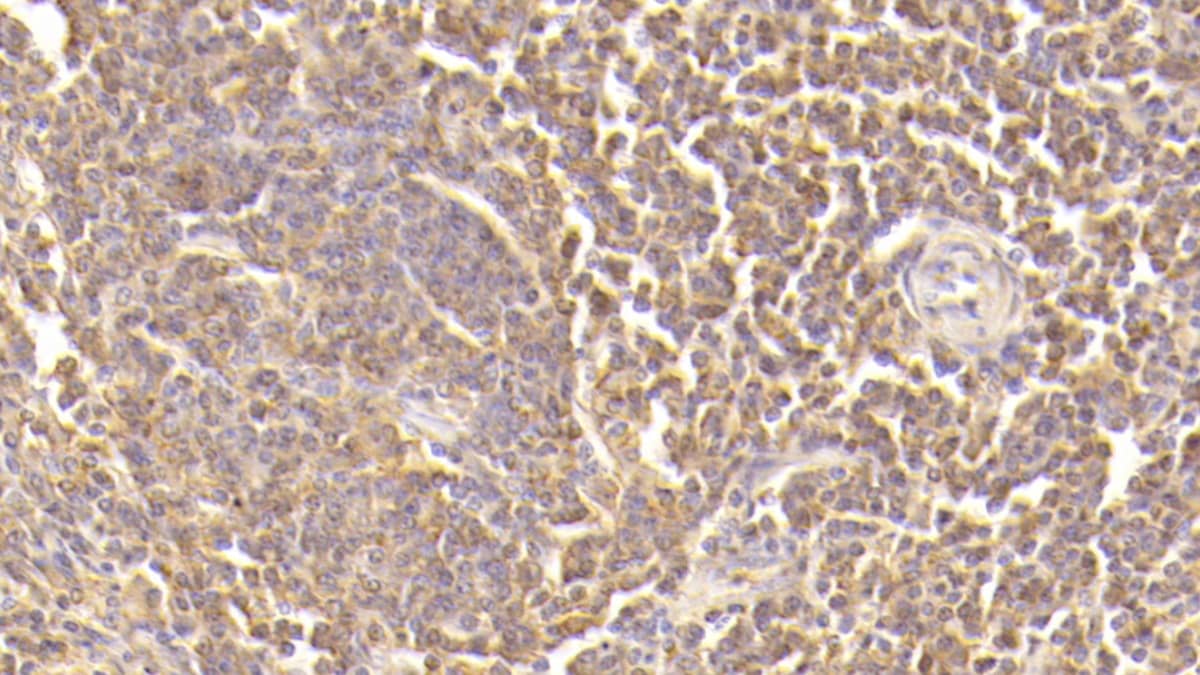 Immunohistochemistry-Paraffin: Complement Component C5a Antibody (D5) [NBP3-41582] - DAB staining on IHC-P; Sample: Human Spleen Tissue; Primary Ab: 30ug/ml NBP3-41582; Second Ab: 2ug/mL HRP-Linked Caprine Anti-Mouse IgG Polyclonal Antibody