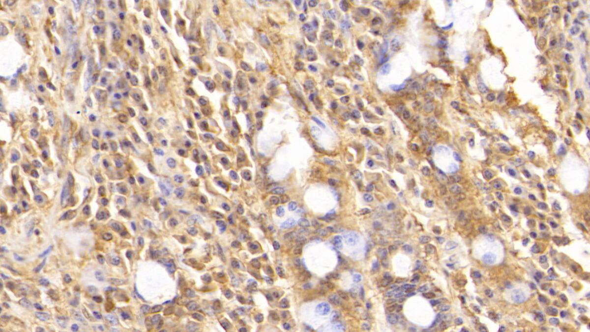 Immunohistochemistry-Paraffin: Complement Component C5a Antibody (D5) [NBP3-41582] - DAB staining on IHC-P; Sample: Human Small intestine Tissue; Primary Ab: 30ug/ml NBP3-41582; Second Ab: 2ug/mL HRP-Linked Caprine Anti-Mouse IgG Polyclonal Antibody