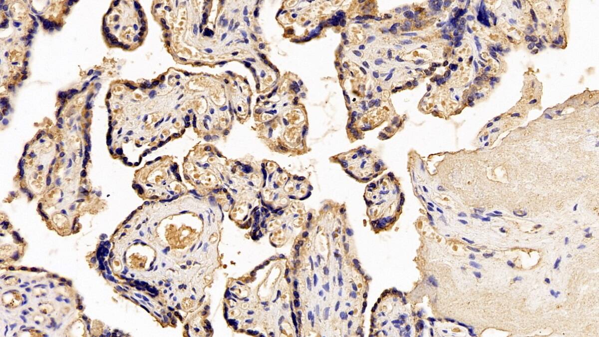 Immunohistochemistry-Paraffin: Placental Lactogen/CSH1 Antibody (C2) [NBP3-41583] - DAB staining on IHC-P; Sample: Human Placenta Tissue; Primary Ab: 20ug/ml NBP3-41583; Second Ab: 2ug/mL HRP-Linked Caprine Anti-Mouse IgG Polyclonal Antibody