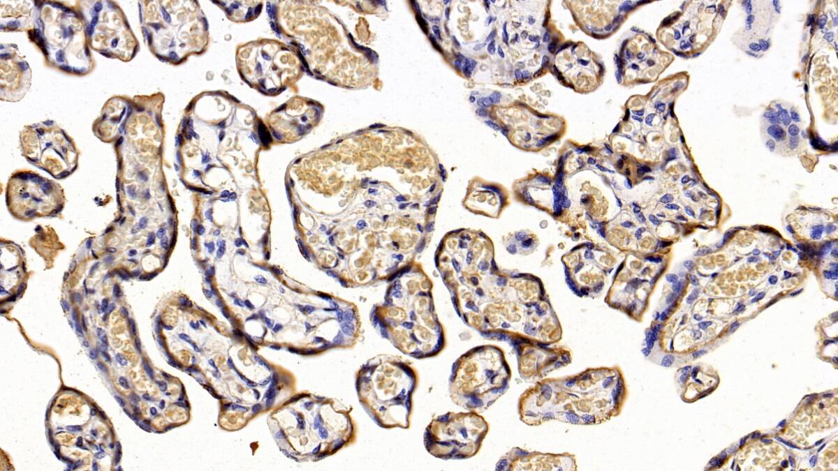 Immunohistochemistry-Paraffin: Placental Lactogen/CSH1 Antibody (C3) [NBP3-41584] - DAB staining on IHC-P; Sample: Human Placenta Tissue; Primary Ab: 30ug/ml NBP3-41584; Second Ab: 2ug/mL HRP-Linked Caprine Anti-Mouse IgG Polyclonal Antibody