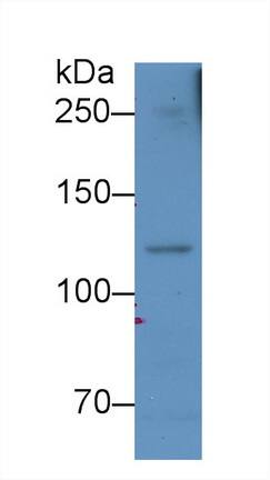 Western Blot: Complement Component C5a Antibody (D2) [NBP3-41586] - Sample: Rat Serum Primary Ab: 3ug/ml NBP3-41586; Second Ab: 0.2ug/mL HRP-Linked Caprine Anti-Mouse IgG Polyclonal Antibody