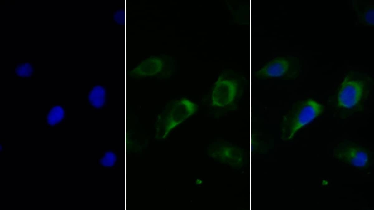 Immunocytochemistry /Immunofluorescence: Fc gamma RIIIB/CD16b Antibody (C1) [NBP3-41587] - FITC staining on IF; Sample: Human U2OS cell; Primary Ab: 30ug/ml NBP3-41587; Second Ab: 5ug/ml FITC-Linked Caprine Anti-Mouse IgG Polyclonal Antibody