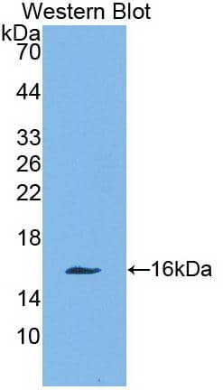 Western Blot: Galectin-10 Antibody (C2) [NBP3-41588] - Sample: Recombinant protein.