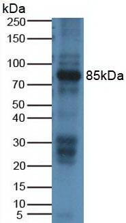 Western Blot: ABP1/AOC1 Antibody (15#) [NBP3-41592] - Western Blot Rat Placenta Tissue Primary Ab: 2ug/mL NBP3-41592; Second Ab: 1:5000 Dilution of HRP-Linked Rabbit Anti-Mouse IgG Ab