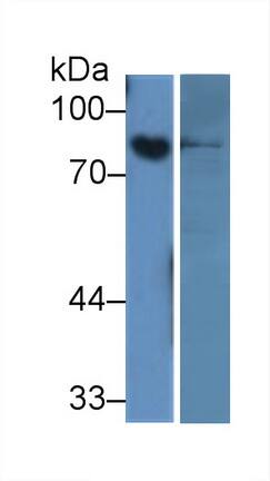 Western Blot: ABP1/AOC1 Antibody (15#) [NBP3-41592] - Sample: Lane1: Rat Placenta lysate; Lane2: Rat Small intestine lysate; Primary Ab: 2ug/ml NBP3-41592; Second Ab: 0.2ug/ml HRP-Linked Caprine Anti-Mouse IgG Polyclonal Antibody