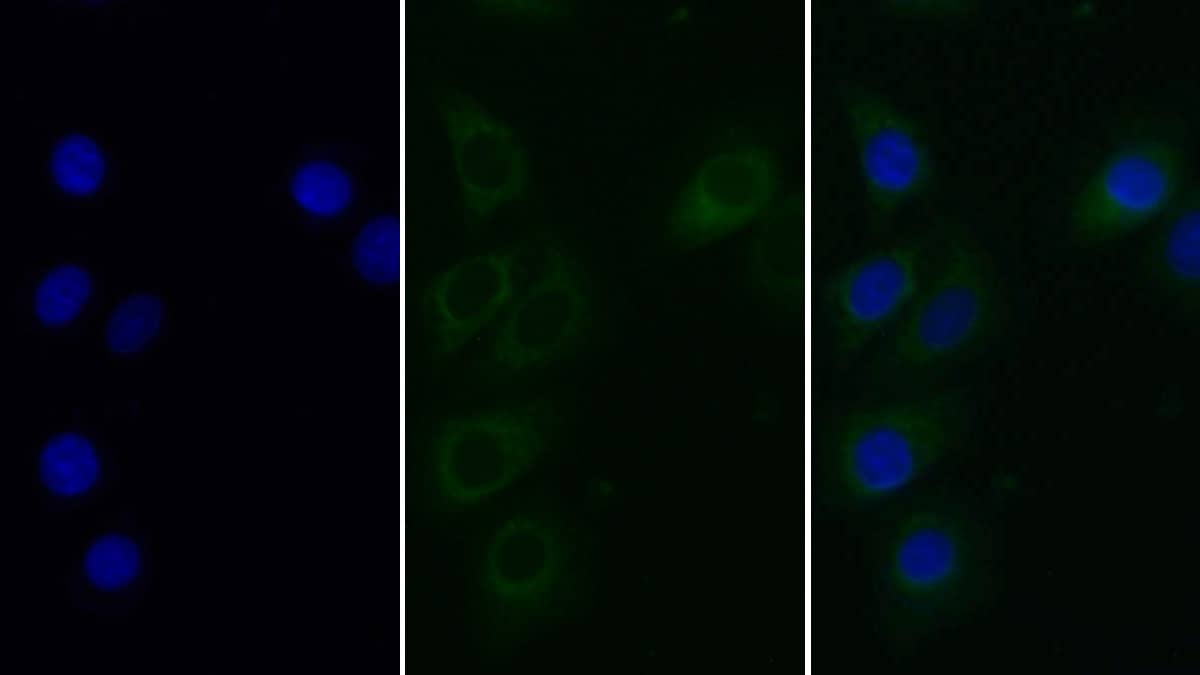 Immunocytochemistry /Immunofluorescence: Heparanase/HPSE Antibody (C303) [NBP3-41593] - FITC staining on IF; Sample: Human Hela cell; Primary Ab: 30ug/ml NBP3-41593; Second Ab: 5ug/ml FITC-Linked Caprine Anti-Mouse IgG Polyclonal Antibody