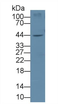 Western Blot: IL-19 Antibody (E5) [NBP3-41595] - Sample: HepG2 cell lysate Primary Ab: 2ug/ml NBP3-41595; Second Ab: 0.2ug/mL HRP-Linked Caprine Anti-Mouse IgG Polyclonal Antibody