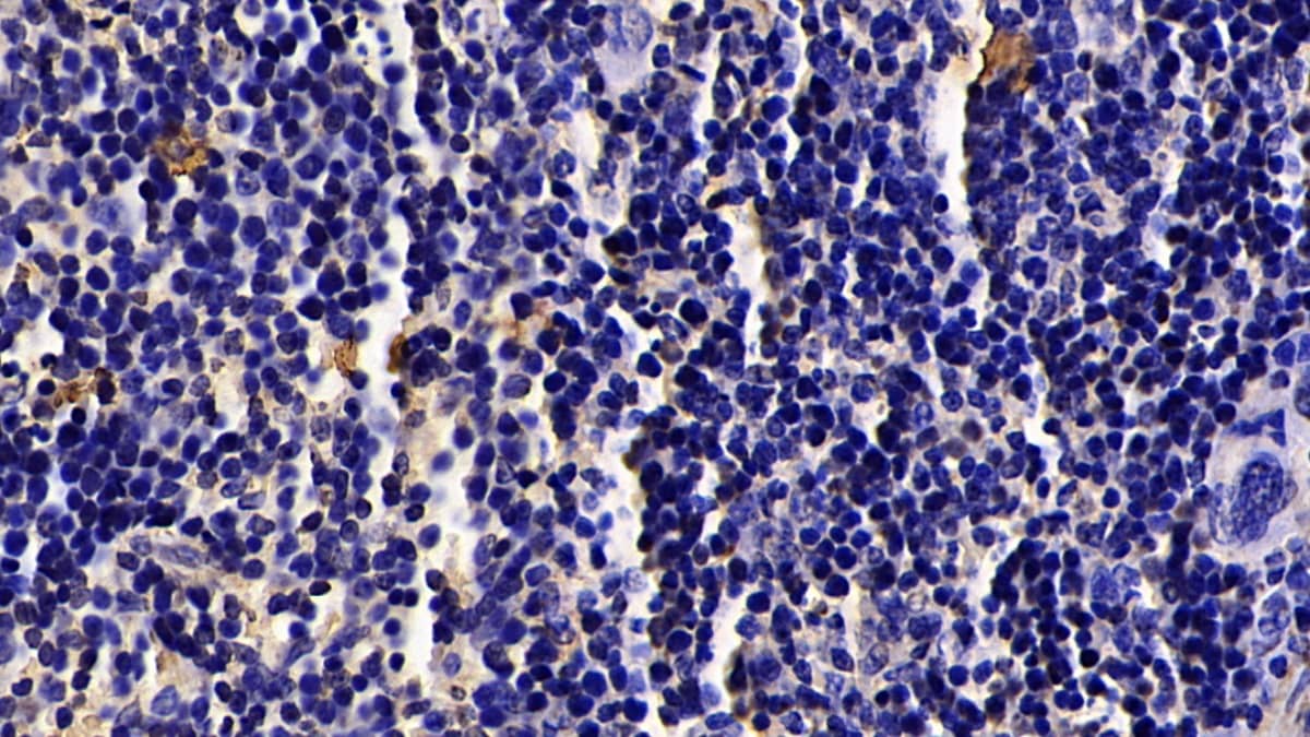 Immunohistochemistry-Paraffin: Granzyme K Antibody (C3) [NBP3-41596] - DAB staining on IHC-P; Sample: Mouse Spleen Tissue; Primary Ab: 30ug/ml NBP3-41596; Second Ab: 2ug/mL HRP-Linked Caprine Anti-Mouse IgG Polyclonal Antibody