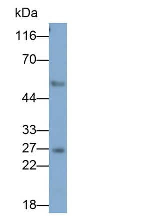 Western Blot: Granzyme K Antibody (C3) [NBP3-41596] - Sample: Rat Lung lysate Primary Ab: 0.1ug/ml NBP3-41596; Second Ab: 0.2ug/mL HRP-Linked Caprine Anti-Mouse IgG Polyclonal Antibody