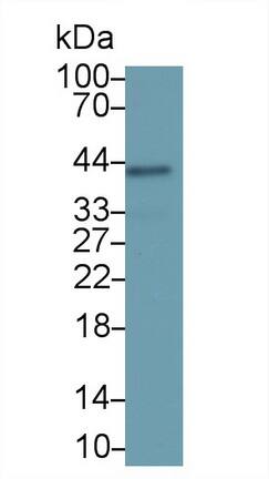 Western Blot: Serpin B3/SCCA1 Antibody (D5) [NBP3-41600] - Sample: 293T cell lysate Primary Ab: 2ug/ml NBP3-41600; Second Ab: 0.2ug/mL HRP-Linked Caprine Anti-Mouse IgG Polyclonal Antibody