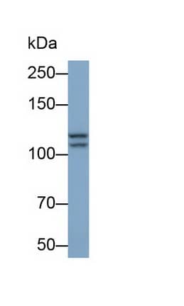 Western Blot: Insulysin/IDE Antibody (C1) [NBP3-41608] - Sample: K562 cell lysate Primary Ab: 0.5ug/ml NBP3-41608; Second Ab: 0.2ug/mL HRP-Linked Caprine Anti-Mouse IgG Polyclonal Antibody