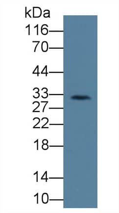 Western Blot: KIR2DS4/CD158i Antibody (C3) [NBP3-41615] - Sample: Rat Lymph node lysate; Primary Ab: 3ug/ml NBP3-41615; Second Ab: 0.2ug/mL HRP-Linked Caprine Anti-Mouse IgG Polyclonal Antibody