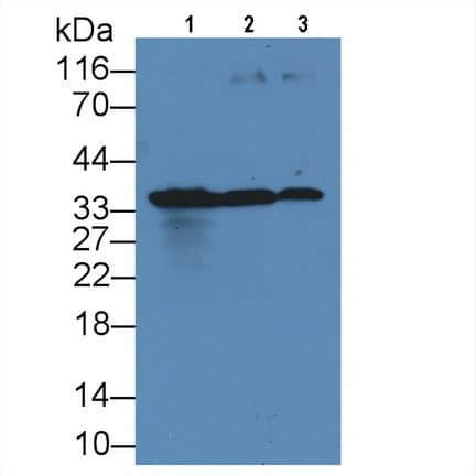 Western Blot: KIR2DS4/CD158i Antibody (C7) [NBP3-41616] - Sample: Lane1: 293T cell lysate; Lane2: Hela cell lysate; Lane3: K562 cell lysate Primary Ab: 3ug/ml NBP3-41616; Second Ab: 0.2ug/mL HRP-Linked Caprine Anti-Mouse IgG Polyclonal Antibody