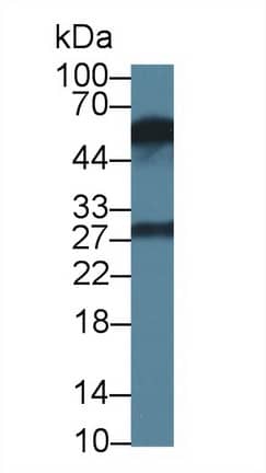 Western Blot: KIR2DS4/CD158i Antibody (C2) [NBP3-41617] - Sample: Rat Lymph node lysate; Primary Ab: 3ug/ml NBP3-41617; Second Ab: 0.2ug/mL HRP-Linked Caprine Anti-Mouse IgG Polyclonal Antibody