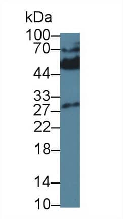 Western Blot: KIR2DS4/CD158i Antibody (C2) [NBP3-41617] - Sample: Rat Spleen lysate; Primary Ab: 3ug/ml NBP3-41617; Second Ab: 0.2ug/mL HRP-Linked Caprine Anti-Mouse IgG Polyclonal Antibody