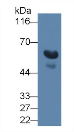 Western Blot: TGF-beta 3 Antibody (C14) [NBP3-41618] - Sample: Human Serum Primary Ab: 3ug/ml NBP3-41618; Second Ab: 0.2ug/mL HRP-Linked Caprine Anti-Mouse IgG Polyclonal Antibody