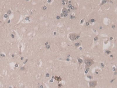 Immunohistochemistry-Paraffin: TGF-beta 3 Antibody (C14) [NBP3-41618] - DAB staining on IHC-P; Sample: Human Cerebrum Tissue; Primary Ab: 30ug/ml NBP3-41618; Second Ab: 2ug/mL HRP-Linked Caprine Anti-Mouse IgG Polyclonal Antibody