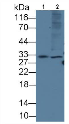 Western Blot: KIR2DS4/CD158i Antibody (C4) [NBP3-41619] - Sample: Lane1: Rat Lymph node lysate; Lane2: Rat Spleen lysate Primary Ab: 3ug/ml NBP3-41619; Second Ab: 0.2ug/mL HRP-Linked Caprine Anti-Mouse IgG Polyclonal Antibody