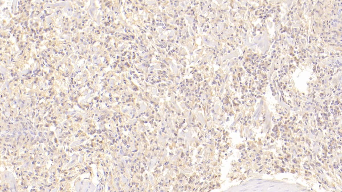 Immunohistochemistry-Paraffin: CD72 Antibody (C7) [NBP3-41620] - DAB staining on IHC-P; Sample: Human Spleen Tissue; Primary Ab: 20ug/ml NBP3-41620; Second Ab: 2ug/mL HRP-Linked Caprine Anti-Mouse IgG Polyclonal Antibody