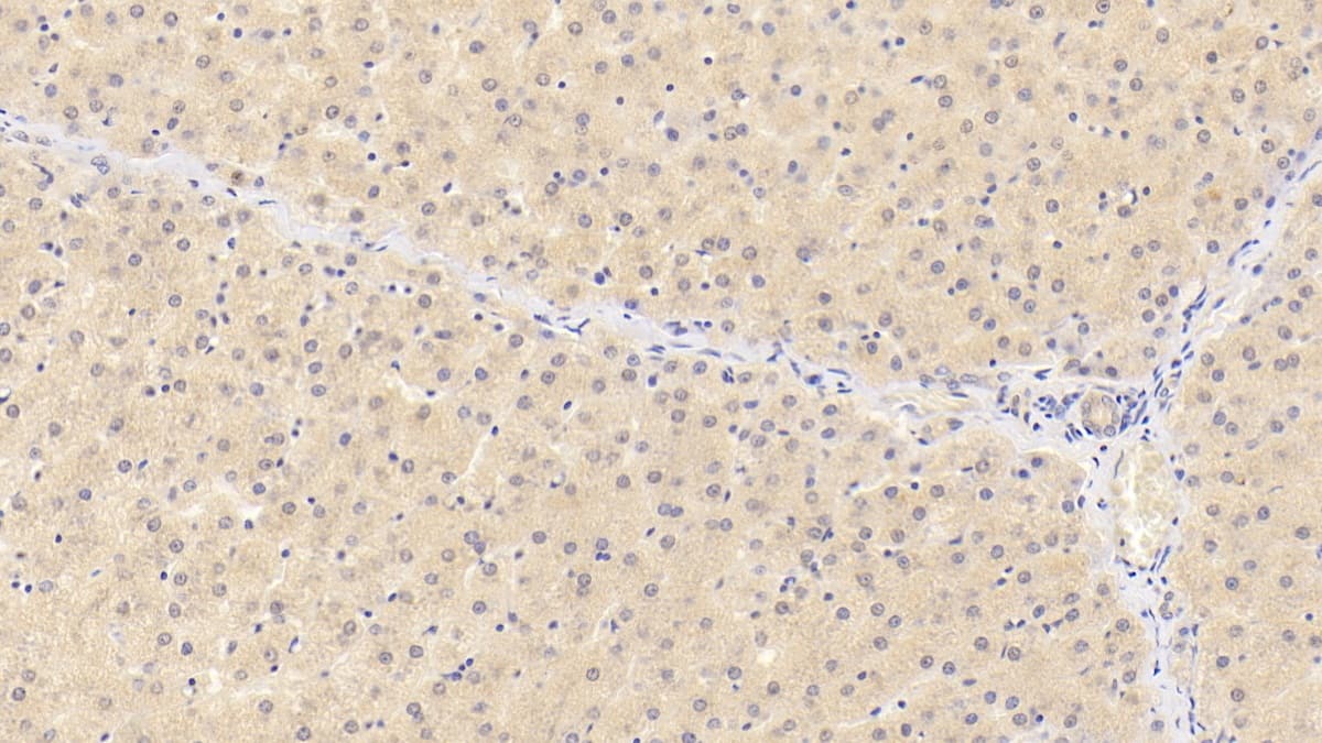 Immunohistochemistry-Paraffin: Siglec-8 Antibody (C1) [NBP3-41621] - DAB staining on IHC-P; Samples: Human Liver Tissue; Primary Ab: 30ug/ml NBP3-41621; Second Ab: 2ug/mL HRP-Linked Caprine Anti-Mouse IgG Polyclonal Antibody