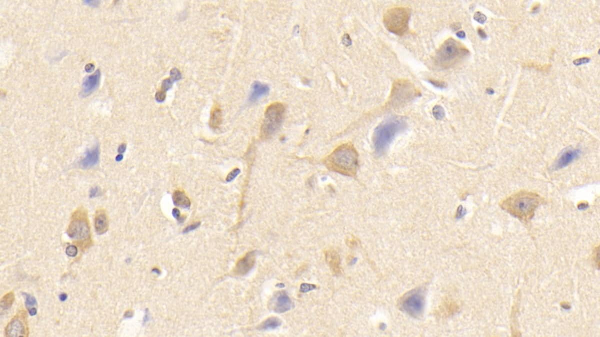 Immunohistochemistry-Paraffin: Siglec-8 Antibody (C1) [NBP3-41621] - DAB staining on IHC-P; Samples: Human Cerebrum Tissue; Primary Ab: 30ug/ml NBP3-41621; Second Ab: 2ug/mL HRP-Linked Caprine Anti-Mouse IgG Polyclonal Antibody