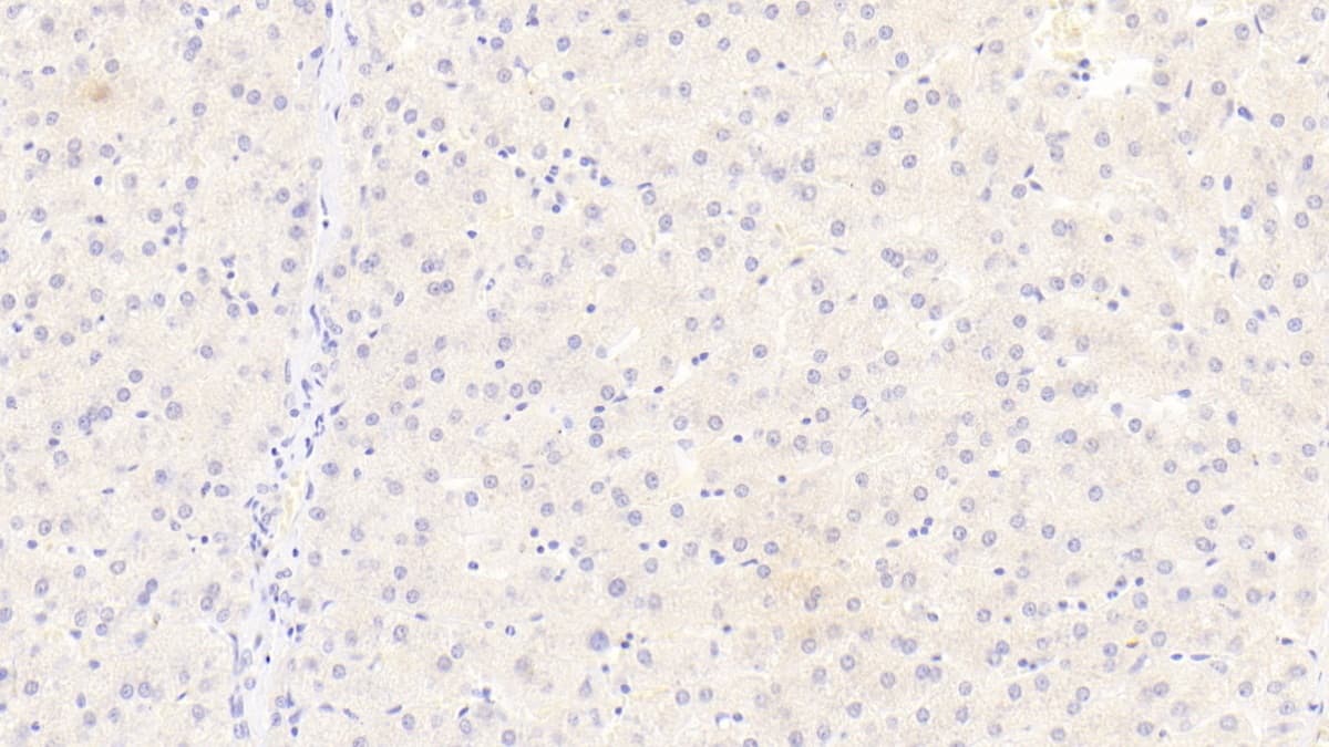 Immunohistochemistry-Paraffin: Siglec-8 Antibody (D1) [NBP3-41622] - DAB staining on IHC-P; Sample: Human Liver Tissue; Primary Ab: 30ug/ml NBP3-41622; Second Ab: 2ug/mL HRP-Linked Caprine Anti-Mouse IgG Polyclonal Antibody