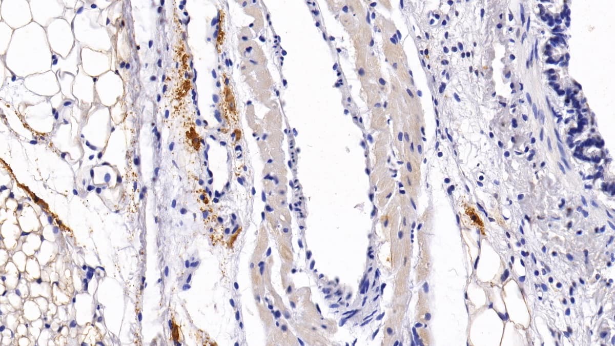 Immunohistochemistry-Paraffin: Bone marrow stromal cell antigen 1/CD157 Antibody (C12) [NBP3-41623] - DAB staining on IHC-P; Sample: Rat Lung Tissue; Primary Ab: 30ug/ml NBP3-41623; Second Ab: 2ug/mL HRP-Linked Caprine Anti-Mouse IgG Polyclonal Antibody