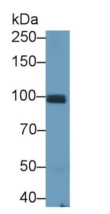 Western Blot: Cadherin-11 Antibody (E9) [NBP3-41624] - Sample: Rat Testis lysatePrimary Ab: 0.08ug/ml NBP3-41624; Second Ab: 0.2ug/mL HRP-Linked Caprine Anti-Mouse IgG Polyclonal Antibody