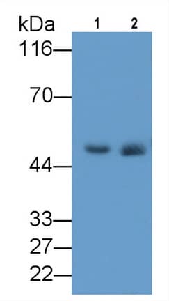 Western Blot: Elastin Antibody (C4) [NBP3-41626] - Sample: Lane1: Rat Lung lysate; Lane2: Rat Skin lysate Primary Ab: 2ug/ml NBP3-41626; Second Ab: 0.2ug/mL HRP-Linked Rabbit Anti-Mouse IgG Polyclonal Antibody