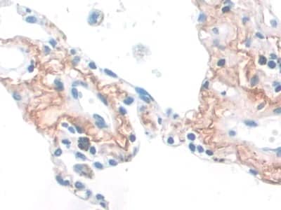 Immunohistochemistry-Paraffin: Elastin Antibody (C4) [NBP3-41626] - DAB staining on IHC-P; Sample: Human Lung Tissue; Primary Ab: 30ug/ml NBP3-41626; Second Ab: 2ug/mL HRP-Linked Caprine Anti-Mouse IgG Polyclonal Antibody