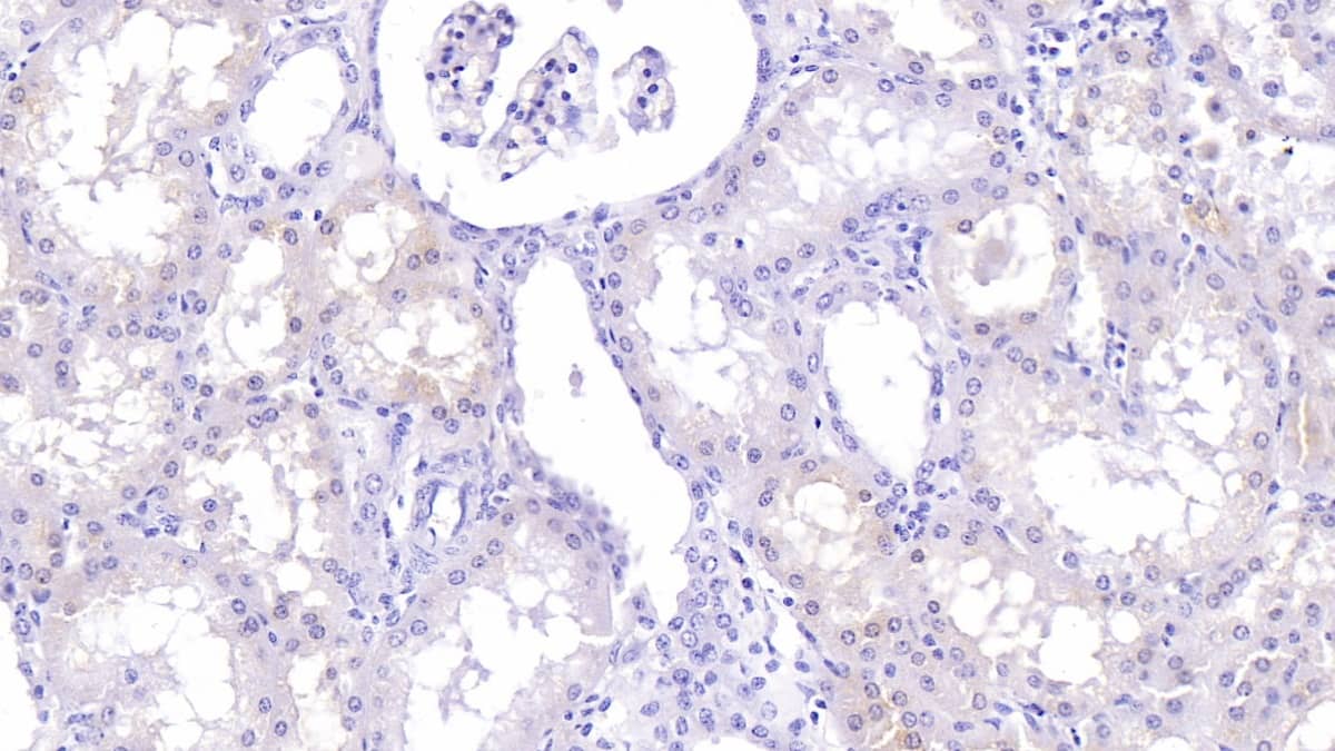 Immunohistochemistry-Paraffin: Lumican Antibody (C10) [NBP3-41627] - DAB staining on IHC-P; Samples: Human Kidney Tissue; Primary Ab: 30ug/ml NBP3-41627; Second Ab: 2ug/mL HRP-Linked Caprine Anti-Mouse IgG Polyclonal Antibody