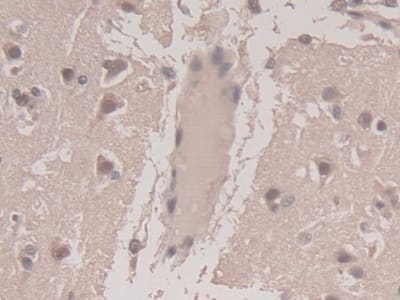 Immunohistochemistry-Paraffin: TGF-beta 3 Antibody (C15) [NBP3-41629] - DAB staining on IHC-P; Sample: Human Cerebrum Tissue; Primary Ab: 30ug/ml NBP3-41629; Second Ab: 2ug/mL HRP-Linked Caprine Anti-Mouse IgG Polyclonal Antibody