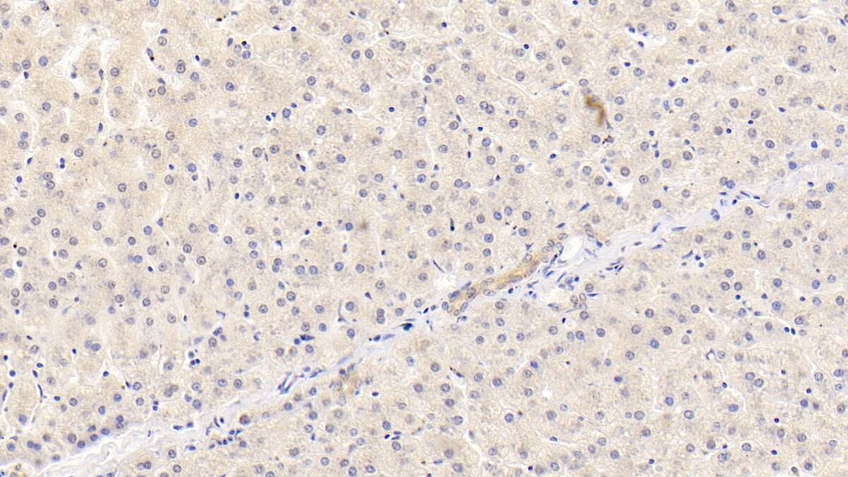 Immunohistochemistry-Paraffin: Apolipoprotein B100/ApoB100 Antibody (D4) [NBP3-41630] - DAB staining on IHC-P; Samples: Human Liver Tissue; Primary Ab: 10ug/ml NBP3-41630; Second Ab: 2ug/mL HRP-Linked Caprine Anti-Mouse IgG Polyclonal Antibody