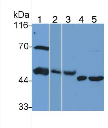 Western Blot: Heparanase/HPSE Antibody (C3) [NBP3-41633] - Sample: Lane1: Rat Serum; Lane2: Rat Placenta lysate; Lane3: Human Placenta lysate; Lane4: HepG2 cell lysate; Lane5: Rat Spleen lysate Primary Ab: 0.5ug/ml NBP3-41633; Second Ab: 0.2ug/mL HRP-Linked Caprine Anti-Mouse IgG Polyclonal Antibody