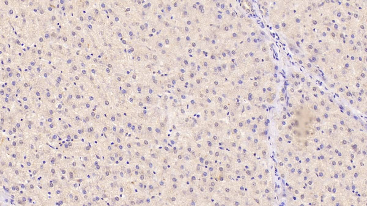 Immunohistochemistry-Paraffin: Angiogenin Antibody (C1) [NBP3-41634] - DAB staining on IHC-P; Sample: Human Liver Tissue; Primary Ab: 40ug/ml NBP3-41634; Second Ab: 2ug/mL HRP-Linked Caprine Anti-Mouse IgG Polyclonal Antibody