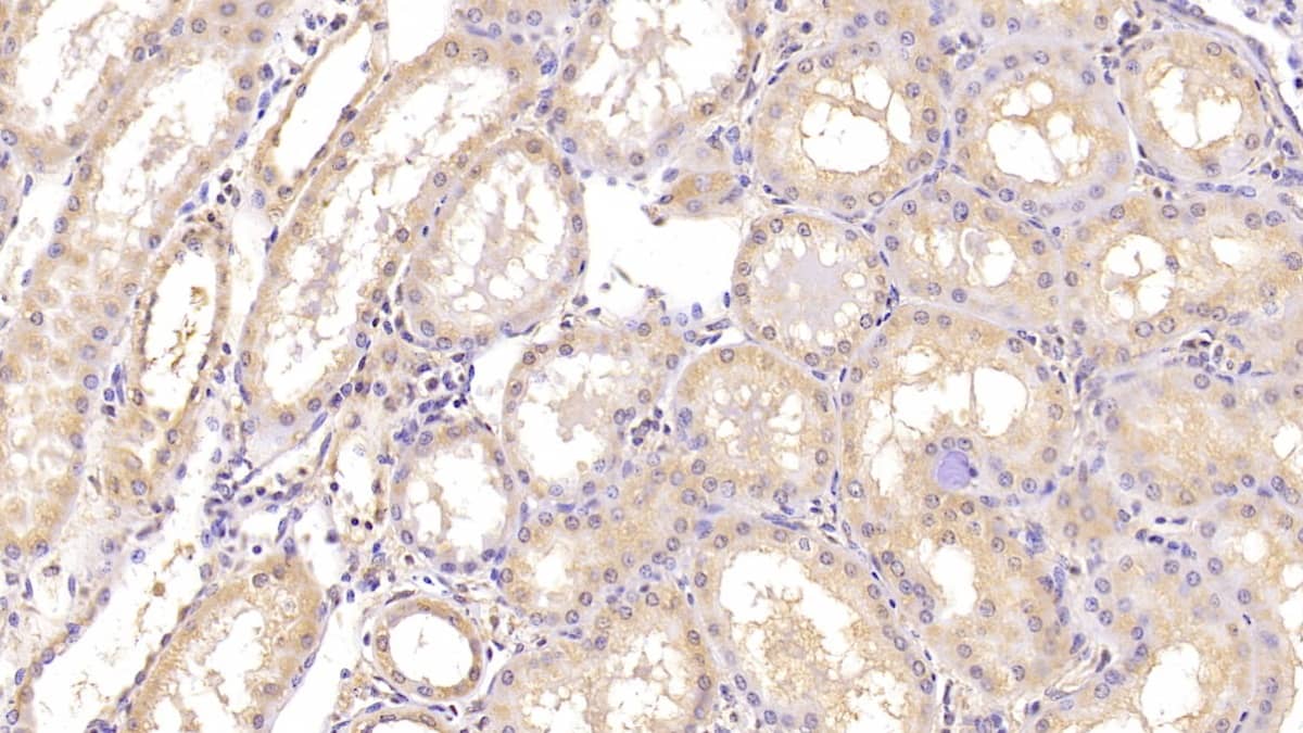 Immunohistochemistry-Paraffin: Angiogenin Antibody (C1) [NBP3-41634] - DAB staining on IHC-P; Sample: Human Kidney Tissue; Primary Ab: 40ug/ml NBP3-41634; Second Ab: 2ug/mL HRP-Linked Caprine Anti-Mouse IgG Polyclonal Antibody