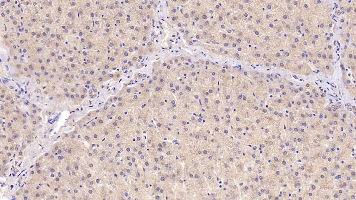 Immunohistochemistry-Paraffin: Angiogenin Antibody (C6) [NBP3-41635] - DAB staining on IHC-P; Sample: Human Liver Tissue; Primary Ab: 20ug/ml NBP3-41635; Second Ab: 2ug/mL HRP-Linked Caprine Anti-Mouse IgG Polyclonal Antibody