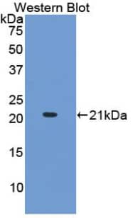 Western Blot: COL15A1 Antibody (E7) [NBP3-41636] - Sample: Recombinant protein.