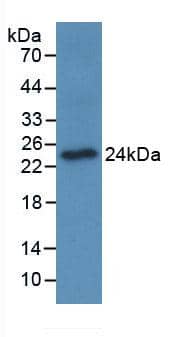 Western Blot: OSCAR Antibody (C2) [NBP3-41638] - Sample: Recombinant OSCAR, Human.