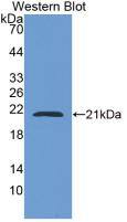 Western Blot: CAP2 Antibody (6#) [NBP3-41643] - Sample: Recombinant CAP2, Human.