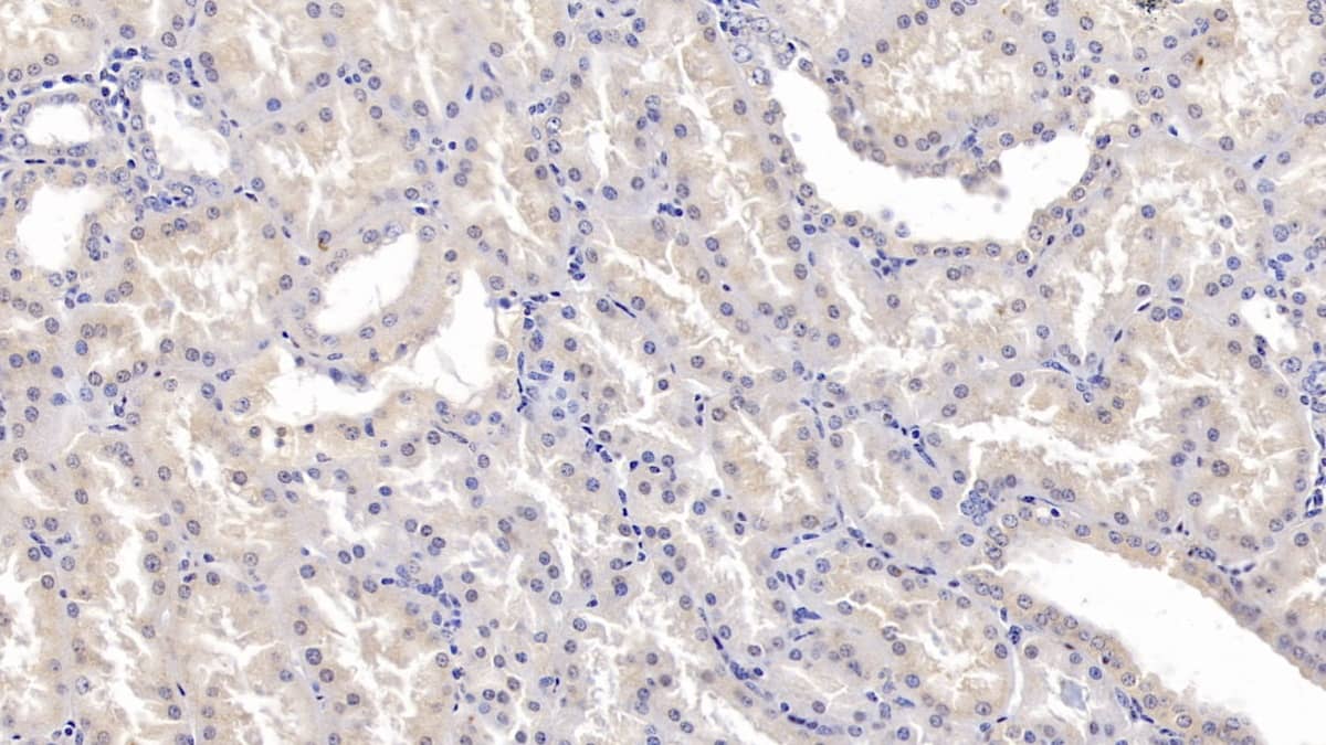 Immunohistochemistry-Paraffin: FKBP12 Antibody (E3) [NBP3-41645] - DAB staining on IHC-P; Samples: Human Kidney Tissue; Primary Ab: 10ug/ml NBP3-41645; Second Ab: 2ug/mL HRP-Linked Caprine Anti-Mouse IgG Polyclonal Antibody