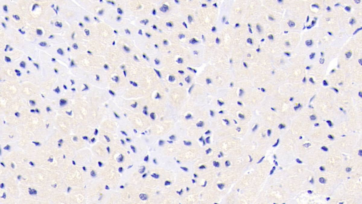 Immunohistochemistry-Paraffin: FKBP12 Antibody (E3) [NBP3-41645] - DAB staining on IHC-P; Samples: Human Heart Tissue; Primary Ab: 10ug/ml NBP3-41645; Second Ab: 2ug/mL HRP-Linked Caprine Anti-Mouse IgG Polyclonal Antibody