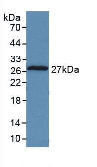 Western Blot: TPT1/TCTP Antibody (C8) [NBP3-41647] - Sample: Recombinant TPT1/TCTP, Human.