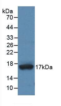 Western Blot: ADAMTS4 Antibody (1#) [NBP3-41648] - Sample: Recombinant ADAMTS4, Human.