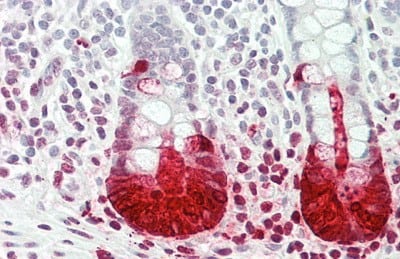 Immunohistochemistry-Paraffin: Reg3A Antibody (4#) [NBP3-41651] - Vector Red staining on IHC-P; Samples: Human Small Intestine Tissue; Primary Ab: 15ug/ml NBP3-41651; Second Ab: 2ug/mL HRP-Linked Caprine Anti-Mouse IgG Monoclonal Antibody