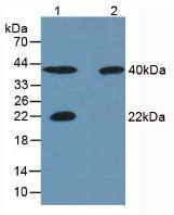 Western Blot: Carbonic Anhydrase III/CA3 Antibody (C2) [NBP3-41653] - Sample: Lane1: Porcine Skeletal Muscle Tissue; Lane2: Rat Skeletal Muscle Tissue; Lane3: Human Liver Tissue; Lane4: Human Lung Tissue.