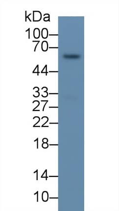 Western Blot: P4HA2 Antibody (C3) [NBP3-41655] - Human Placenta lysate; Primary Ab: 2ug/ml NBP3-41655; Second Ab: 0.2ug/mL HRP-conjugated Rabbit Anti-Mouse IgG Polyclonal Antibody