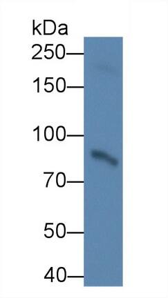 Western Blot: Lysine Hydroxylase 2/PLOD2 Antibody (C1) [NBP3-41656] - Sample: Human Serum Primary Ab: 2ug/ml NBP3-41656; Second Ab: 0.2ug/mL HRP-Linked Caprine Anti-Mouse IgG Polyclonal Antibody