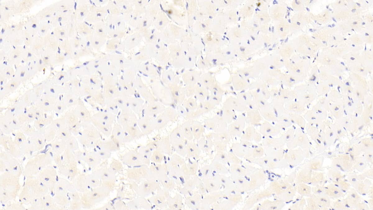 Immunohistochemistry-Paraffin: NCOA3/AIB1 Antibody (D3) [NBP3-41658] - DAB staining on IHC-P; Sample: Human Cardiac Muscle Tissue; Primary Ab: 20ug/ml NBP3-41658; Second Ab: 2ug/mL HRP-Linked Caprine Anti-Mouse IgG Polyclonal Antibody